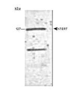 TERT Antibody in Western Blot (WB)