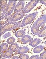 MRP1 Antibody in Immunohistochemistry (Paraffin) (IHC (P))