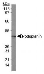 Podoplanin Antibody in Western Blot (WB)