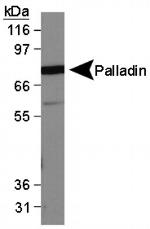 Palladin Antibody in Western Blot (WB)