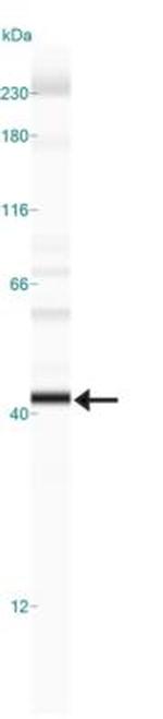 PHD2 Antibody in Western Blot (WB)