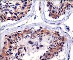 TFAM Antibody in Immunohistochemistry (Paraffin) (IHC (P))