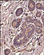 IkB alpha Antibody in Immunohistochemistry (Paraffin) (IHC (P))