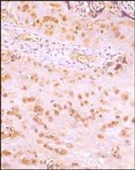 IKK beta Antibody in Immunohistochemistry (Paraffin) (IHC (P))