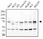 IKK alpha Antibody in Western Blot (WB)