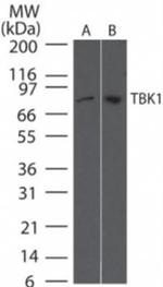 TBK1 Antibody in Western Blot (WB)