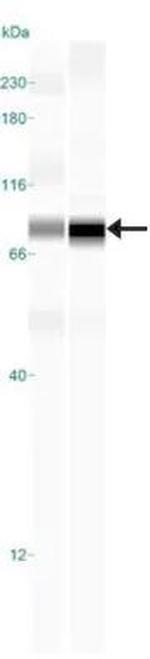 TBK1 Antibody in Western Blot (WB)