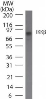 IKK beta Antibody in Western Blot (WB)