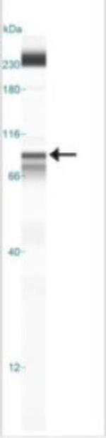 IKK beta Antibody in Western Blot (WB)