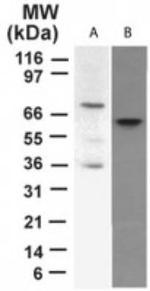 p73 Antibody in Western Blot (WB)