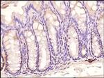 TLR3 Antibody in Immunohistochemistry (Paraffin) (IHC (P))