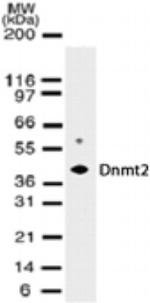 Dnmt2 Antibody in Western Blot (WB)