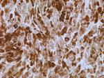 S100A7 Antibody in Immunohistochemistry (Paraffin) (IHC (P))