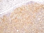 Bi-1 Antibody in Immunohistochemistry (Paraffin) (IHC (P))