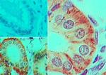 IL-17F Antibody in Immunohistochemistry (Paraffin) (IHC (P))