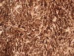 IL-17F Antibody in Immunohistochemistry (Paraffin) (IHC (P))