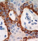 TLR5 Antibody in Immunohistochemistry (Paraffin) (IHC (P))