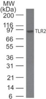 TLR2 Antibody in Western Blot (WB)