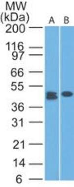 CLEC9A Antibody in Western Blot (WB)