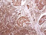 HMGB1 Antibody in Immunohistochemistry (Paraffin) (IHC (P))