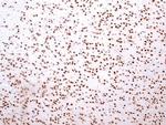 HMGB1 Antibody in Immunohistochemistry (Paraffin) (IHC (P))