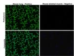 Podoplanin Antibody in Immunohistochemistry (Paraffin) (IHC (P))