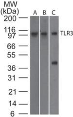 TLR3 Antibody in Western Blot (WB)