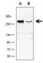 TET1 Antibody in Western Blot (WB)