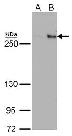 TET1 Antibody in Western Blot (WB)