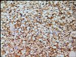 Carbonic Anhydrase IX Antibody in Immunohistochemistry (Paraffin) (IHC (P))