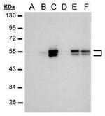 Carbonic Anhydrase IX Antibody in Western Blot (WB)