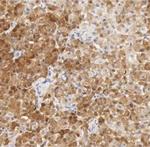 Calpain S1 Antibody in Immunohistochemistry (Paraffin) (IHC (P))