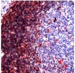 CD43 Antibody in Immunohistochemistry (Paraffin) (IHC (P))