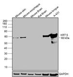 Cytokeratin 5 Antibody