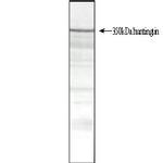 Huntingtin Antibody in Western Blot (WB)