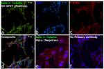 Mouse IgG2a (Heavy chain) Secondary Antibody in Immunocytochemistry (ICC/IF)