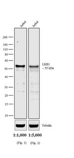 Mouse IgG2a (Heavy chain) Secondary Antibody in Western Blot (WB)