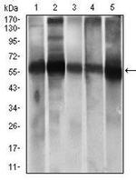 ALDH2 Antibody in Western Blot (WB)