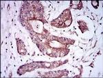 BMPR1A Antibody in Immunohistochemistry (Paraffin) (IHC (P))