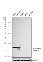 p16INK4a Antibody