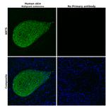 Cytokeratin 5 Antibody in Immunohistochemistry (Paraffin) (IHC (P))