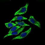 Dynactin 4 Antibody in Immunocytochemistry (ICC/IF)