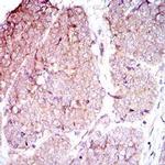 CD104 Antibody in Immunohistochemistry (Paraffin) (IHC (P))