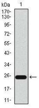 CD104 Antibody in Western Blot (WB)