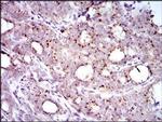 MRPL42 Antibody in Immunohistochemistry (Paraffin) (IHC (P))