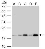 Cofilin Antibody in Western Blot (WB)