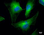 Cofilin Antibody in Immunocytochemistry (ICC/IF)