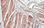 TAGLN Antibody in Immunohistochemistry (Paraffin) (IHC (P))