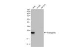 TAGLN Antibody in Western Blot (WB)