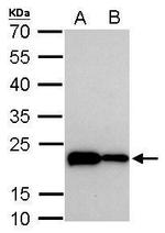 TAGLN Antibody in Western Blot (WB)